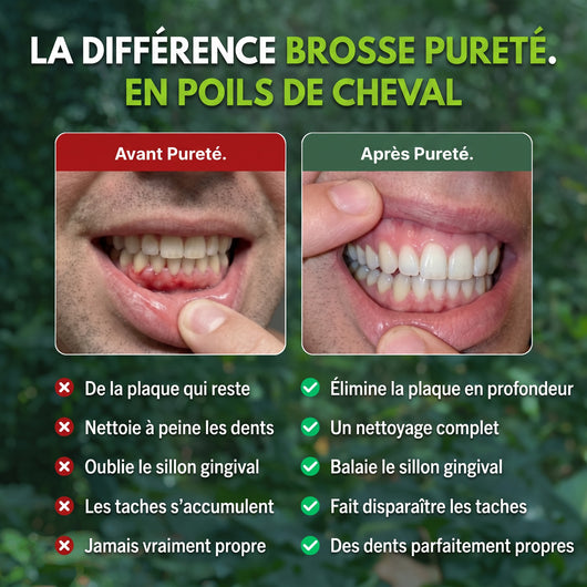 Avant et après le passage à la brosse à dents Pureté.