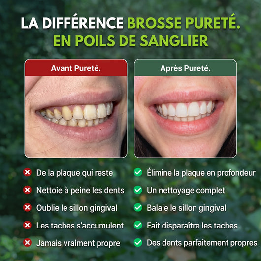 Avant et après le passage à la brosse à dents Pureté.